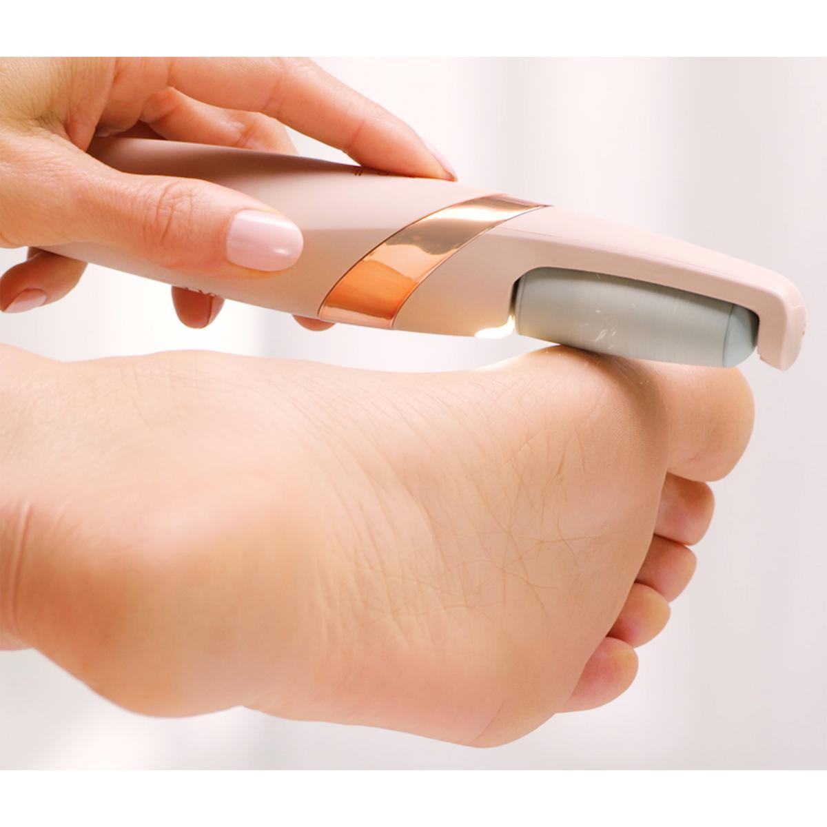 Portable Callus Remover